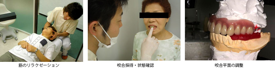 入れ歯の症例紹介 術後の写真2