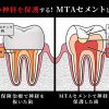Thumbnail of related posts 039