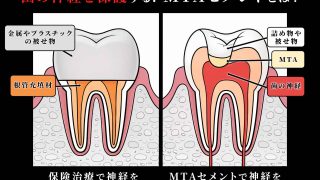 Thumbnail of post image 161
