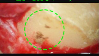 Thumbnail of post image 158