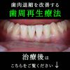 Thumbnail of related posts 100