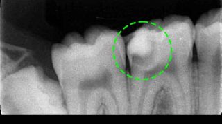 Thumbnail of post image 167