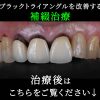Thumbnail of related posts 008