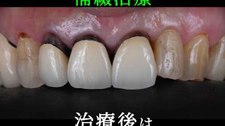 Thumbnail of post image 002
