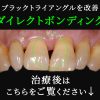 Thumbnail of related posts 056