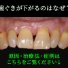 Thumbnail of related posts 131
