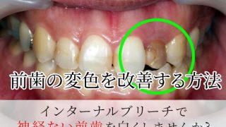Thumbnail of post image 047
